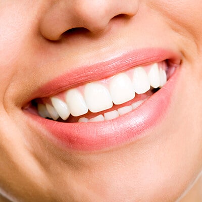 The smiling mouth of a young woman, showing her beautiful white teeth after periodontal surgery in Bellevue, WA. 