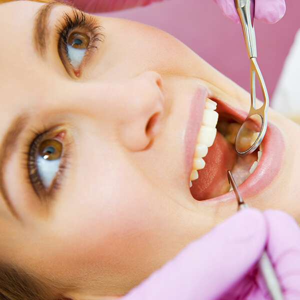 A female is in the dentist's chair with her mouth open, and a dentist is inspecting her teeth.